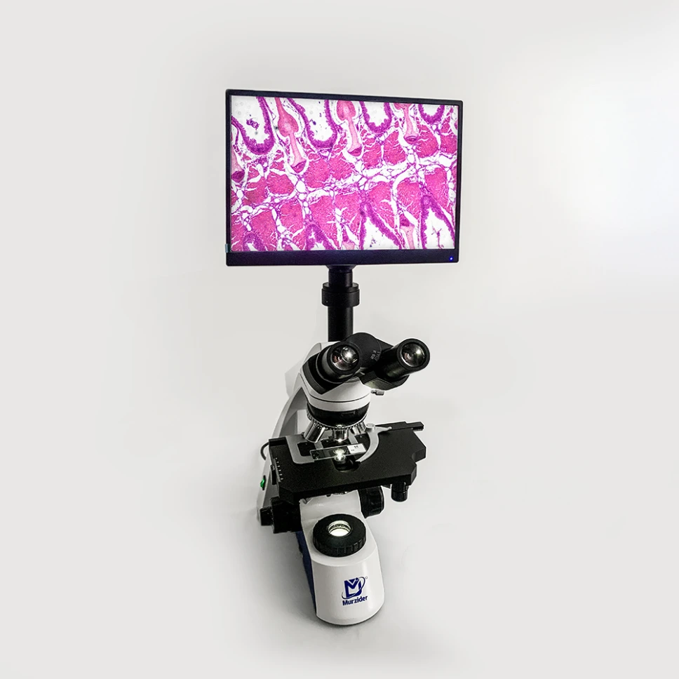 Research Grade Biological microscope + 11.6 inch display screen